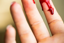 Finger cut